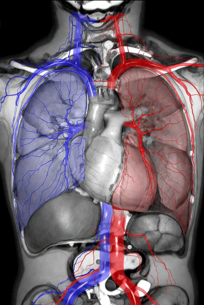 Pulmonary CTA (CTPA): What to Expect, Risks, and Results for Lung Blood ...